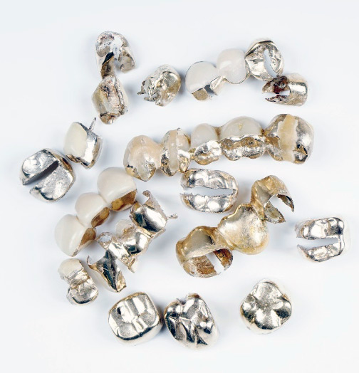 We buy dental gold